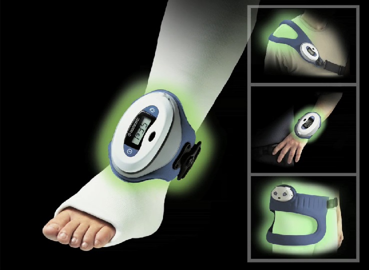 The Physio-Stim from Orthofix can be worn over a cast, brace or clothing.